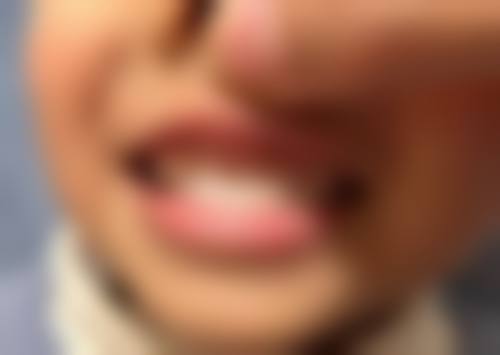 广州好大夫口腔真实实例