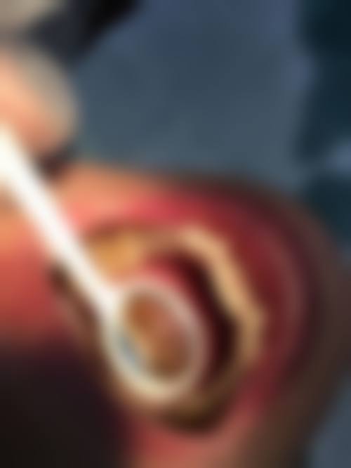 宜春辉荣口腔价格表：合理收费透明消费