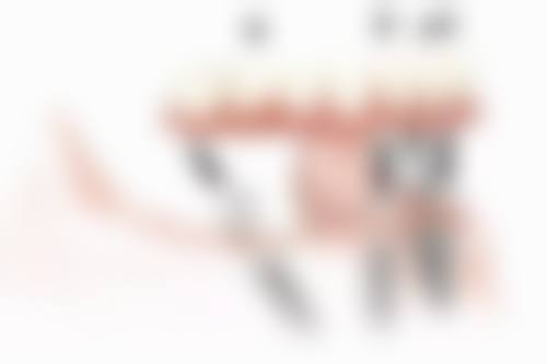 取下烤瓷牙需要注意什么