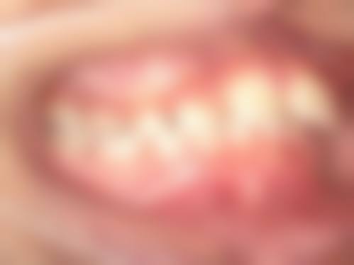 漳州南健口腔（胜利东路店）真实实例：见证牙齿的华丽变身！