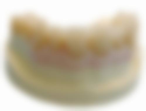 聊城冠县庆华嘉德口腔价格表