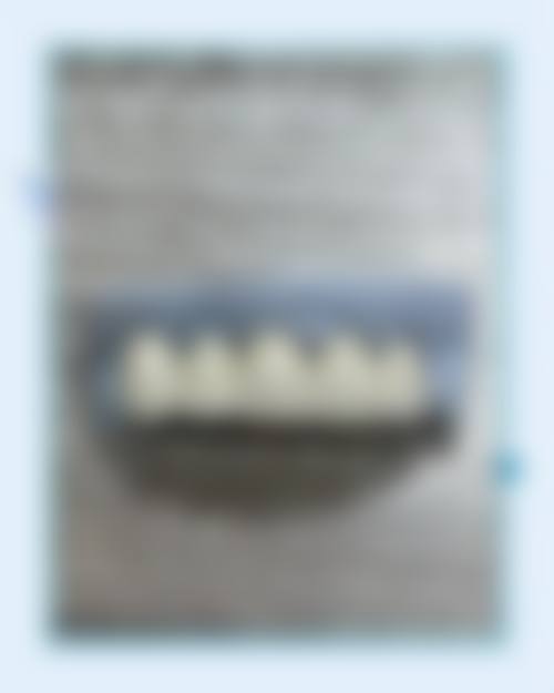 山东潍坊诸城皓济口腔真实实例