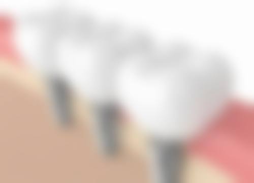 深圳希玛爱康健康辉口腔门诊部真实实例