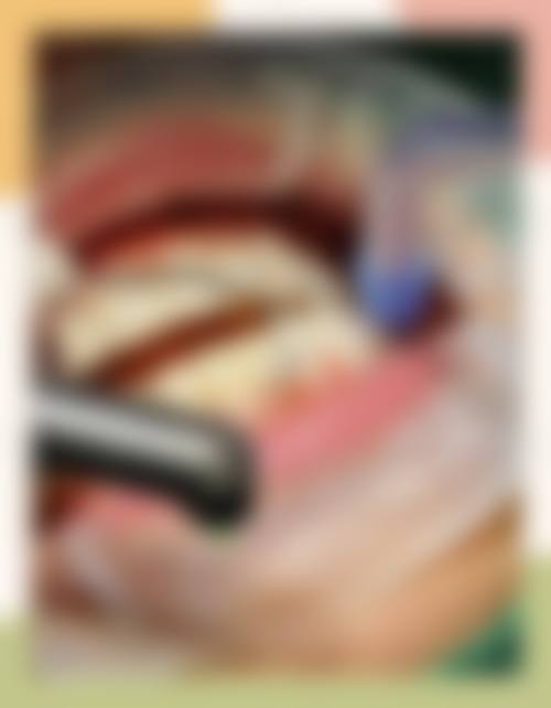 襄阳奥益齿口腔门诊部擅长项目