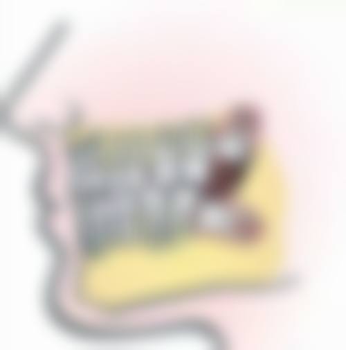 拔牙创伤大小对运动时间有什么影响