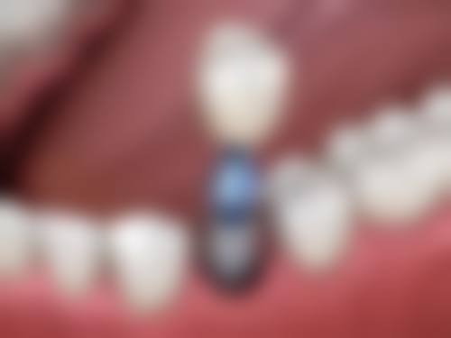 内江牙博士口腔诊所电话号码