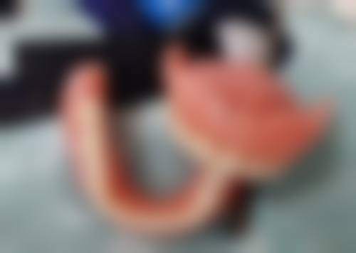 河南南阳方城万超口腔诊所陈旭口碑好不好