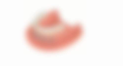 长沙牙典口腔真实实例:见证治疗奇迹