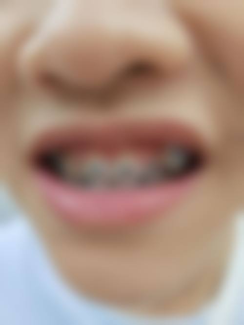 怀仁博诚口腔医院真实实例