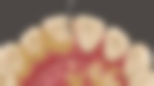 北京臻齿口腔门诊部预约挂号方式:轻松搞定挂号