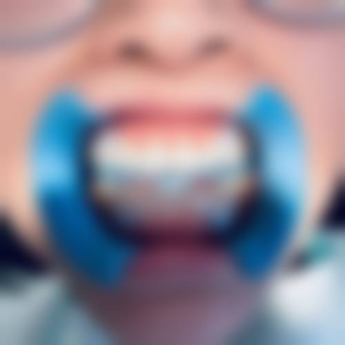西安未央海涛口腔医院仪器设备：精良科技助力看牙！