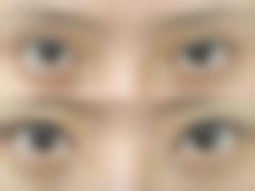 北京联帮医疗美容诊所更擅长的手术项目