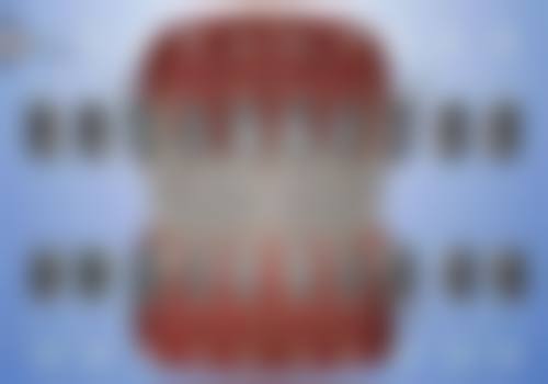 房瑞娟在美学修复与贴面技术上的匠心独运