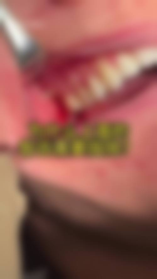 潘树矿就诊体验与患者真实评价