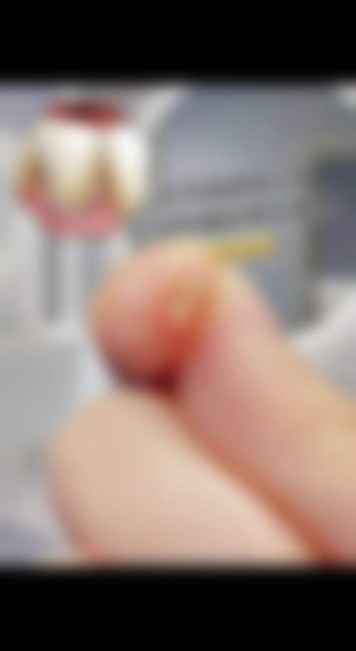 如何选择李志良医生：就诊指南与避坑建议